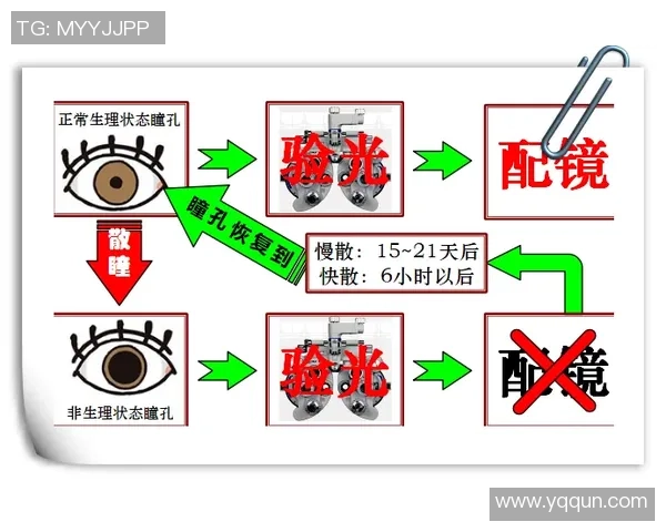 慢散瞳后能否安全打篮球对眼睛健康的影响与注意事项解析